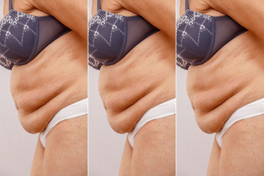 Menopause Apron Belly Why And How To Get Rid Of It The Silver Diaries