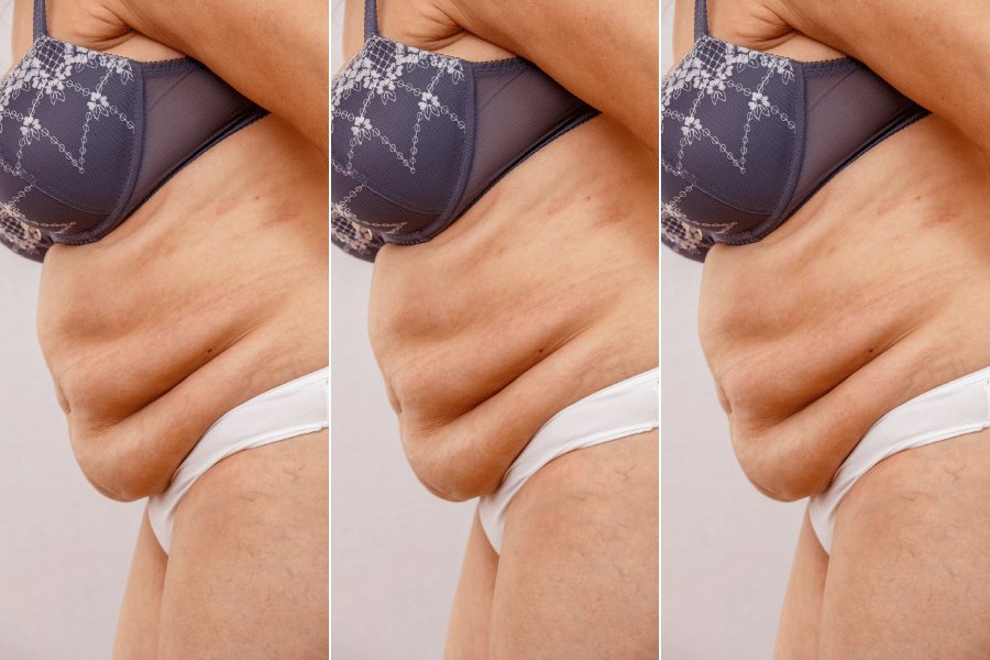 Menopause Apron Belly Why How To Get Rid Of It The Silver Diaries
